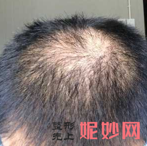 合（hé）肥瑤海福華醫療（liáo）美容門診部簡介,附上發際線種（zhǒng）植收費表及案例