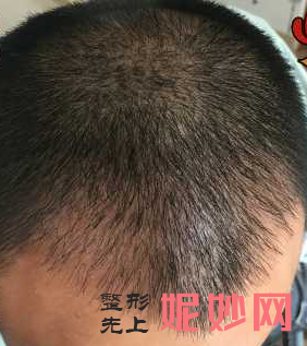 合肥瑤海福華醫療美容門診部簡介,附上發際（jì）線種植收（shōu）費表及案例