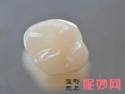 烤瓷牙和嵌體哪個好?烤瓷牙和嵌體的區別詳解