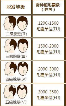 南寧貞韓微創無痕植發技術（shù） 防脫、固發、生發（fā）、植發（fā）均可見效果