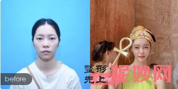 北（běi）京清木（mù）是私人整形醫院嗎?靠譜不?有保（bǎo）障嗎?沈薇案例效果_價格表